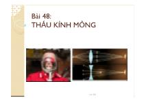 Bài 48: Thấu kính mỏng